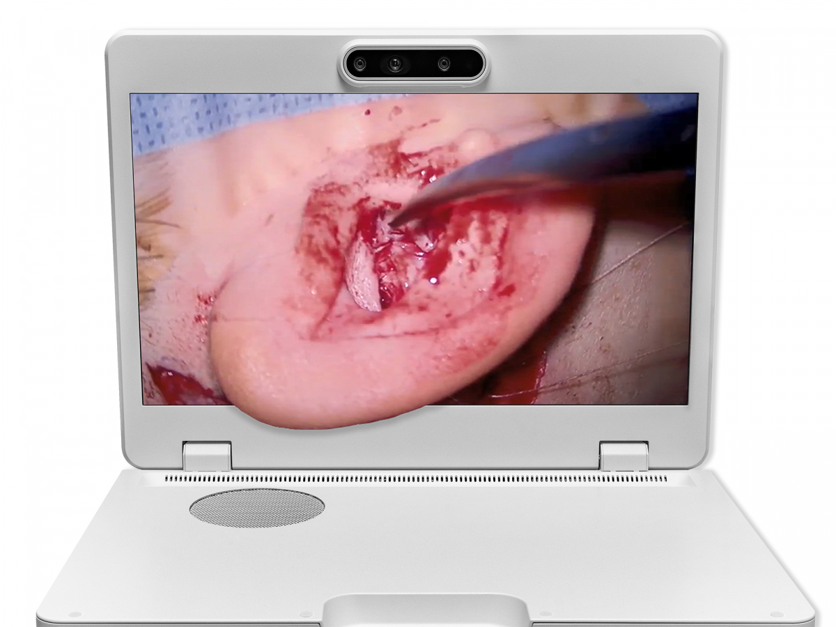 达擎之＂Heads-up 3D显微手术显示系统＂，整合4K裸眼3D显示及眼球追踪系统，具备快速追踪人眼移动位置功能，减轻医师长时间维持固定姿势的负担，让医师能有更宽广清晰的3D立体视野及更舒适的姿势来执行手术。